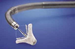 Mitral Valve Regurgitation: Studies Now Enrolling at UVA