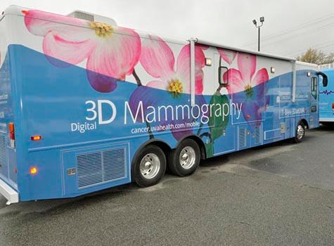 breast cancer screening