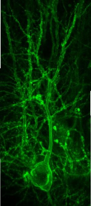 Image of a neurotransmission inside the brain.