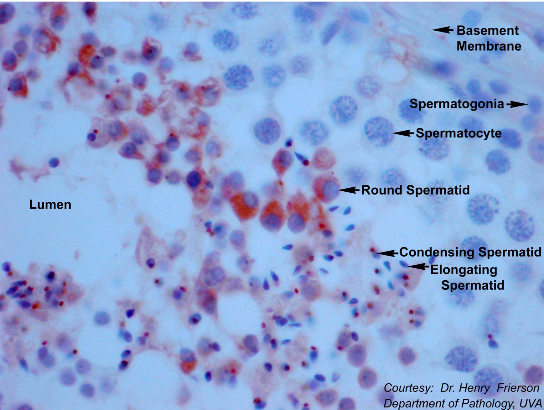 A stain showing sperm developing within the human testis. More info available upon request.