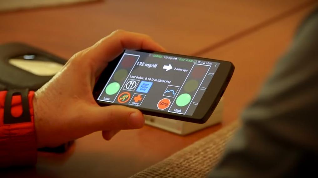 The artificial pancreas will be tested in an international clinical trial.