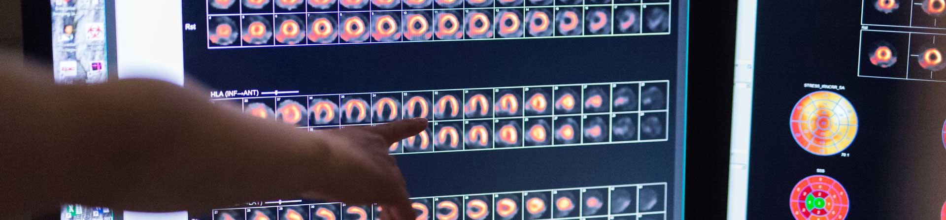 heart imaging scan