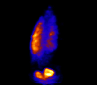 High-tech imaging of a lung.