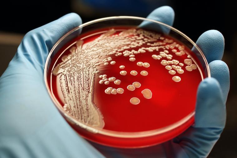 Colonies of drug-resistant S. aureus bacteria grow in a lab dish. 