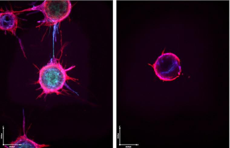 Untreated blood vessel sprouts (left), compared with blood vessel sprouts following treatment with microRNA.