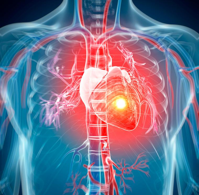 Each year, more than 800,000 Americans suffer a heart attack.