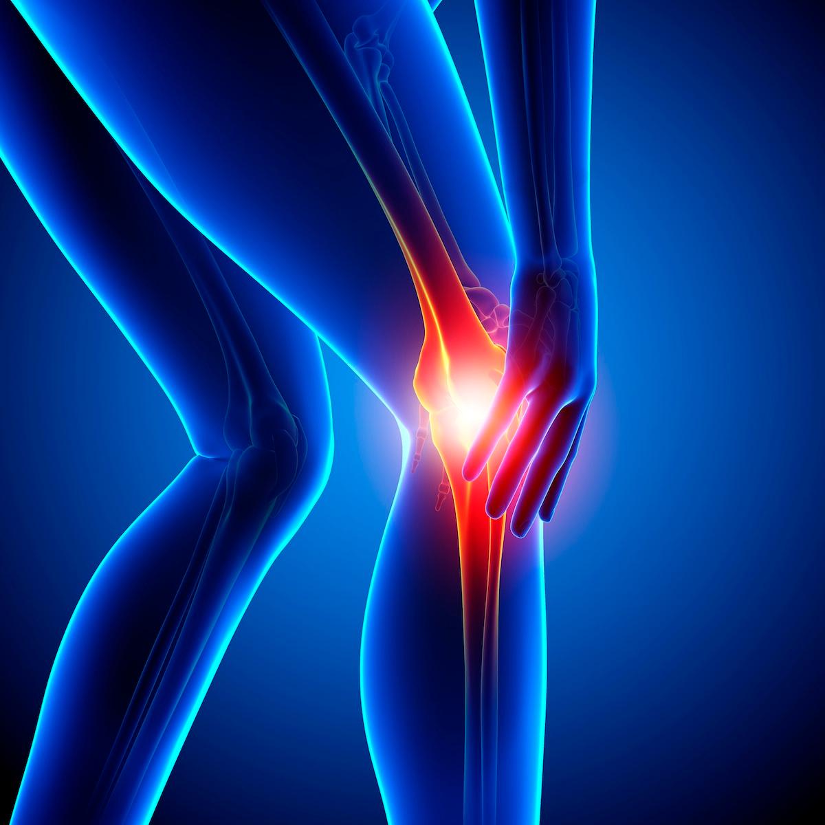 Knee pain, computer artwork.