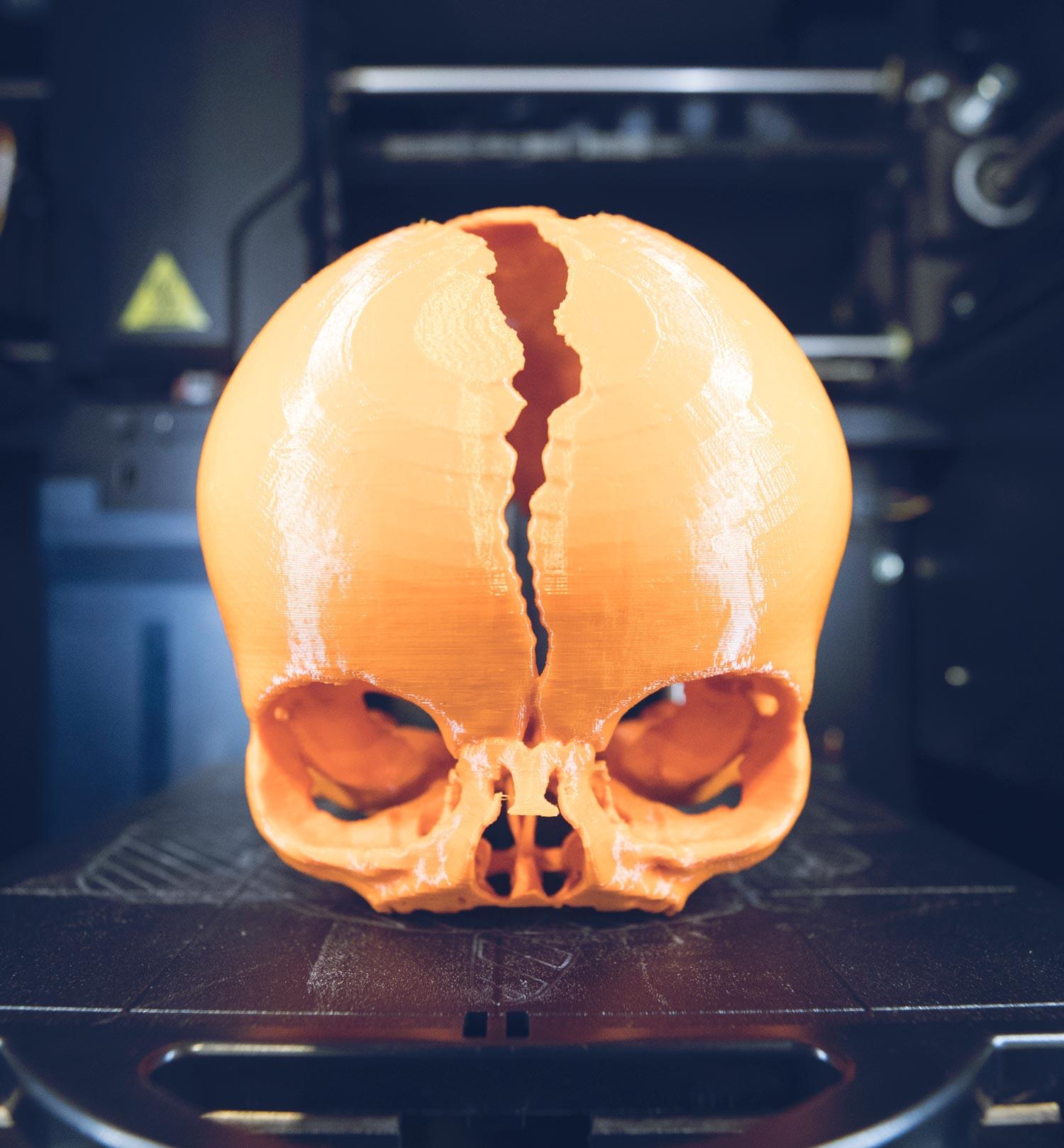 Life-sized, 3D skulls like this one are helping our plastic surgeons provide better patient care and better training for their students.