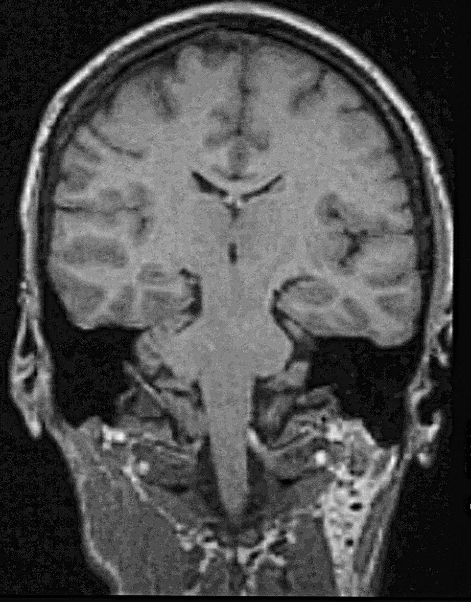 Imaging shows brain cross-section