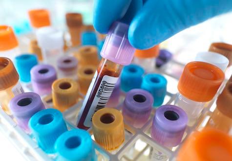 Person selecting a blood sample