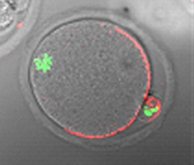 Microscopic image of ovulated mammalian egg within zona pellucida just prior to fertilization showing, in red, the location on the egg surface of the protein to be studied in the Gates Foundation project.