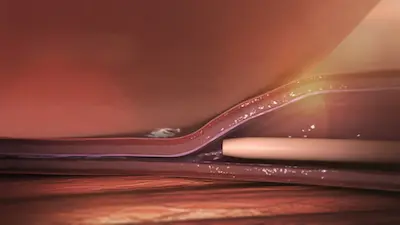 venaseal, varicose veins