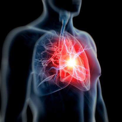 More than 700,000 Americans have heart attacks each year.