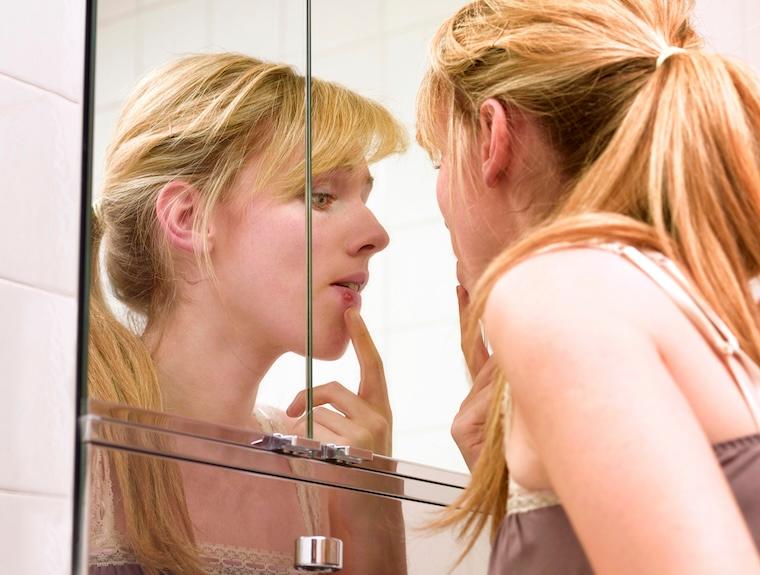 School of Medicine researchers have discovered an unknown way the virus that causes cold sores (and many cases of genital herpes) reactivates in the body. This could pave the way for preventive treatments.