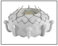 Mitral Valve Regurgitation: Studies Now Enrolling at UVA