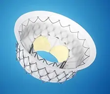 Mitral Valve Regurgitation: Studies Now Enrolling at UVA