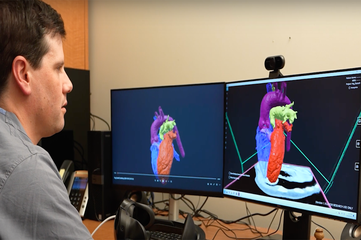 Doctor looks at 3d models of a congenital heart defect