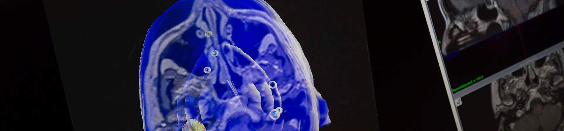 Scan of brain