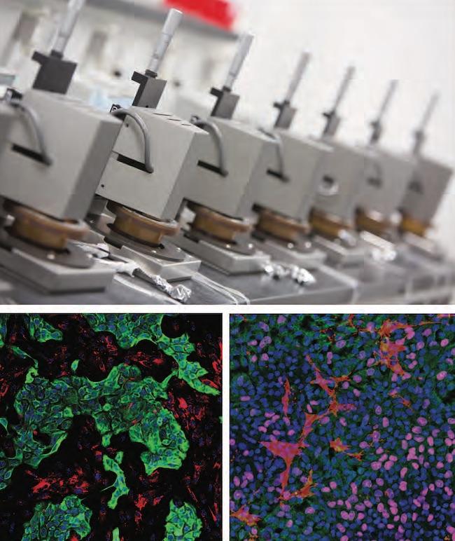 The cancer model. Top image: HemoShear Therapeutics Flow Devices used to recreate the tumor microenvironment using REVEAL-Tx with potential applications for creating patient avatars. Bottom left (pancreatic) and bottom right (lung) images: tumor and stromal cells are imaged following co-culture with blood vessel cells exposed to tumor hemodynamics.