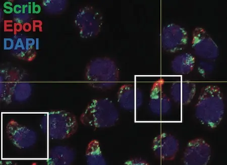 Erythroid progenitor cells