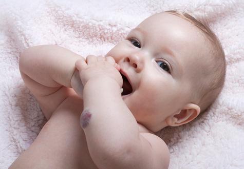 Baby with vascular birthmark on arm happily sticks hand in mouth